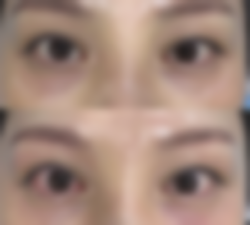 四、渭南协和医院医疗美容科实例