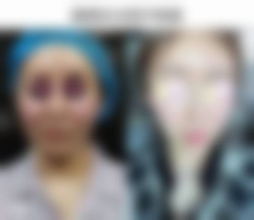 七、威海一诺世纪医疗美容诊所价格表：（仅供参考）