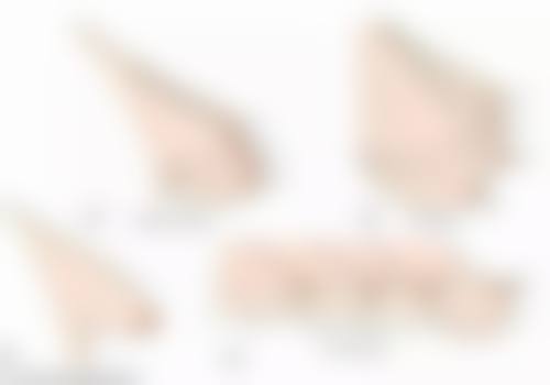 五、四川成都美容整形医院私密科口碑评价