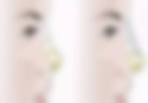 五、南京江宁海蓝医疗美容门诊部怎么预约：