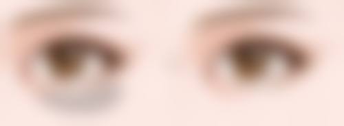 五、西安爱洛慕梵整形医院实例