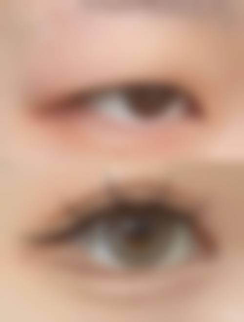 伍明政医生微整形怎么样可靠吗？