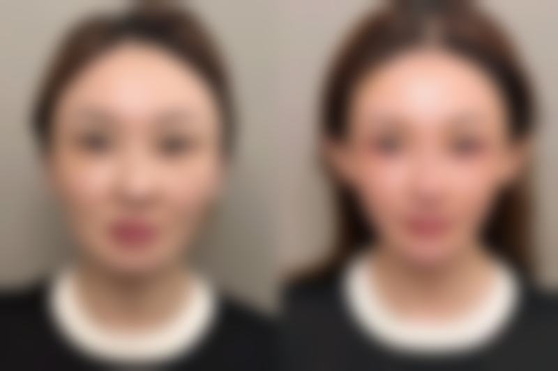 六、西安爱洛慕梵整形医院怎么预约：