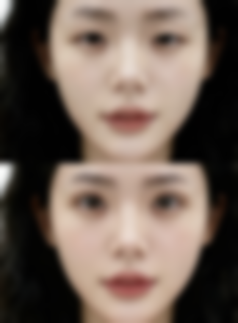 七、鞍山王静峙医疗美容诊所价格表：（仅供参考）