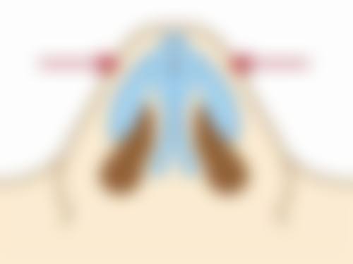 七、台州艺星医美整形医院(口腔正畸科)价格表:(仅供参考)