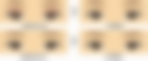 全身抽脂如何操作？——分部位手术安心法