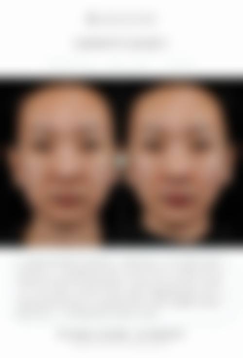 六、吉安中 心人民医院整形外科怎么预约: