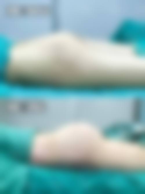 五、玉林现代医院怎么预约：