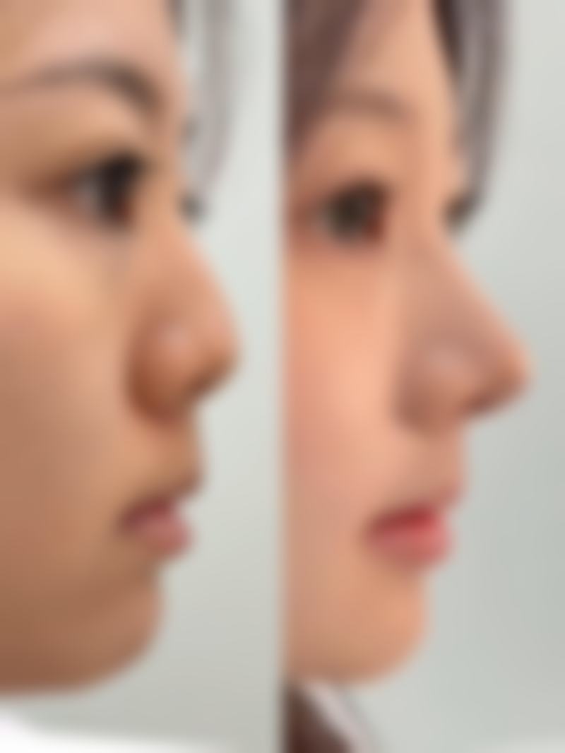 六、海口美兰红妆医学美容医院怎么预约：