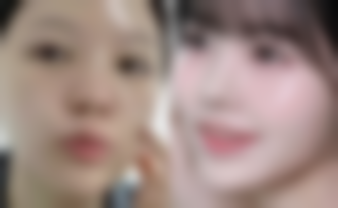 夫妻都是双眼皮，孩子真会是单眼皮吗？解析遗传规律与眼皮形态的奇妙关联 