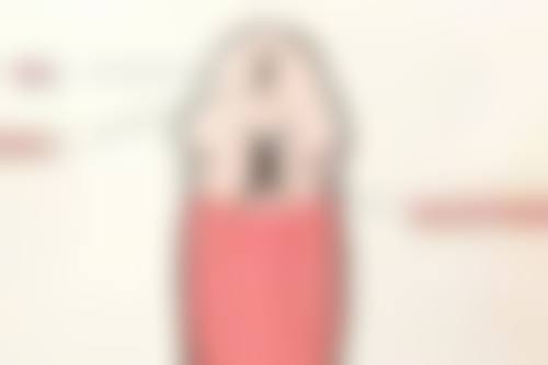 眼袋增生能否修复正常？多种修复方法揭秘