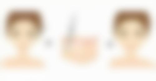 邓东医生怎么预约？