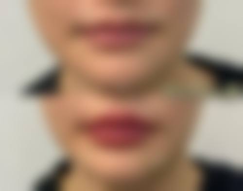 四、南京金之歆整形医院开展的主要项目和特色项目: