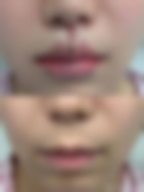 七、南京金之歆整形医院价格表:(仅供参考)