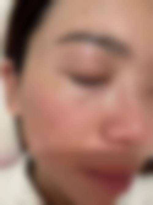 七、深圳鹏辉医疗美容门诊部价格表：（仅供参考）