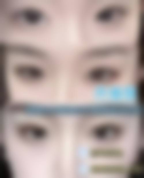 王明青医生项目价格表参考