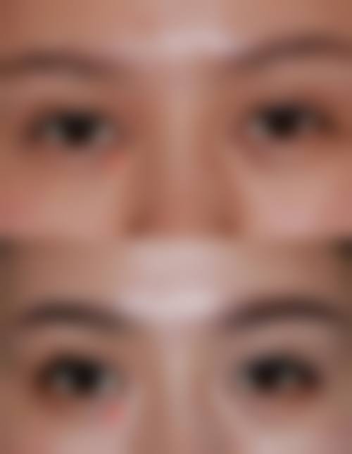 王明青医生烧伤和外伤后疤痕畸形治疗怎么样可靠吗?