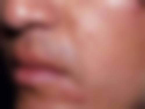 石春蕊医生口碑和评价