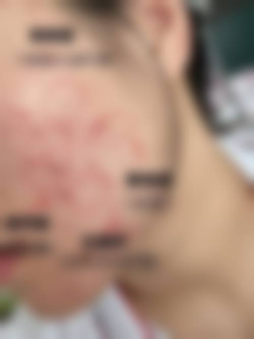 石春蕊医生怎么预约？