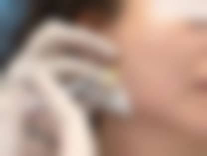 六、保定妍栢美容医院怎么预约：