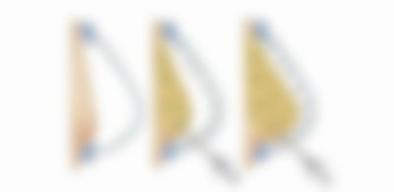 杨晓英医生注射联合光电综合抗衰实例