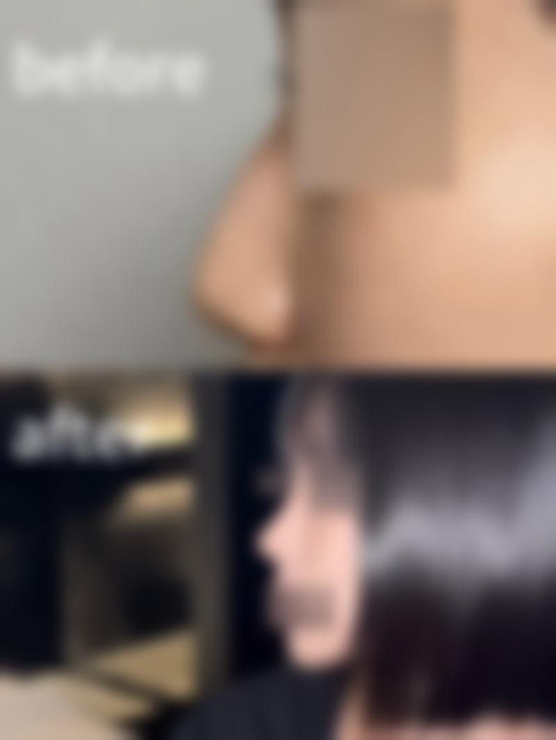 七、息县名人整形医院真实的顾客评价如下: