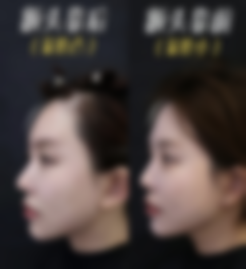 总结：做好准备，安心变得更美