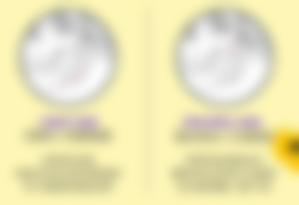 北京圣嘉新医疗美容医院上睑提肌上睑下垂矫正术（轻度）的真实评价