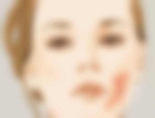 如何预防脸被手抓伤留疤