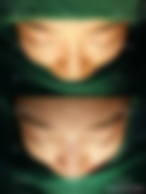 桂行军 医生眼部整形怎么样可靠吗？