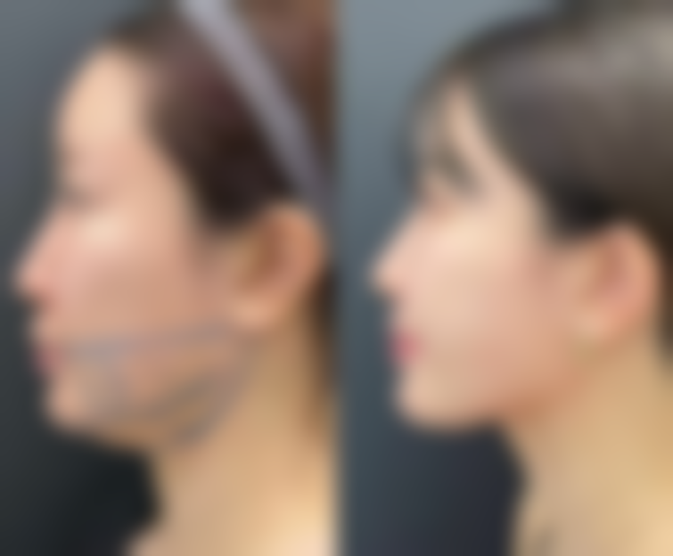 脸被手抓伤后正确处理的重要性