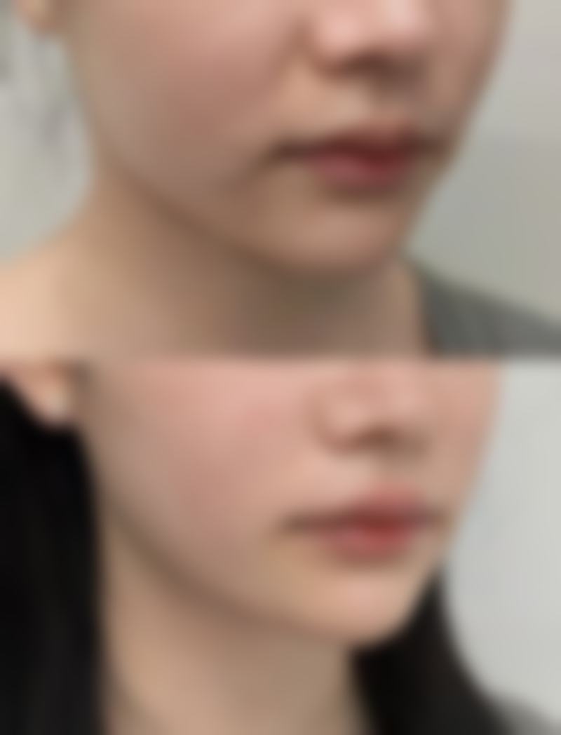 六、郴州青源医疗美容门诊部怎么预约：