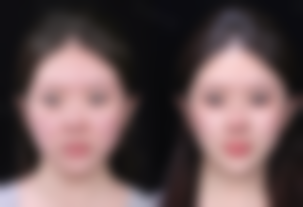 七、固镇星晨整形医院价格表：（仅供参考）