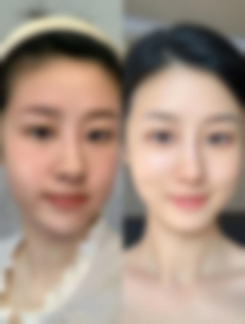 一只双眼皮究竟有啥优势？展现个性风格