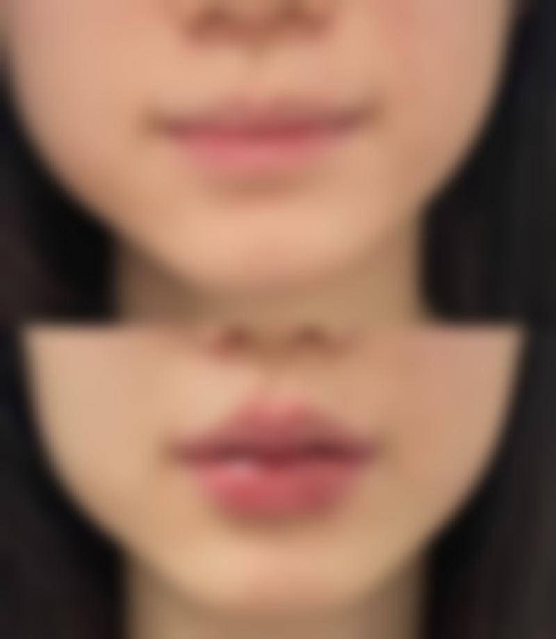 一只双眼皮究竟为何这么独特？增添艺术美感