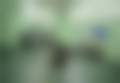 康华医生激光祛斑实例