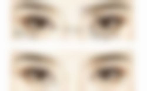 用牙签划出双眼皮的优势，值得你长久坚持