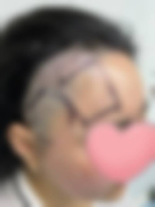 五、济南即美天玑医疗美容整形实例