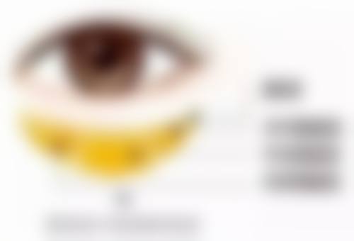 五、贵阳科珑小可整形医院实例