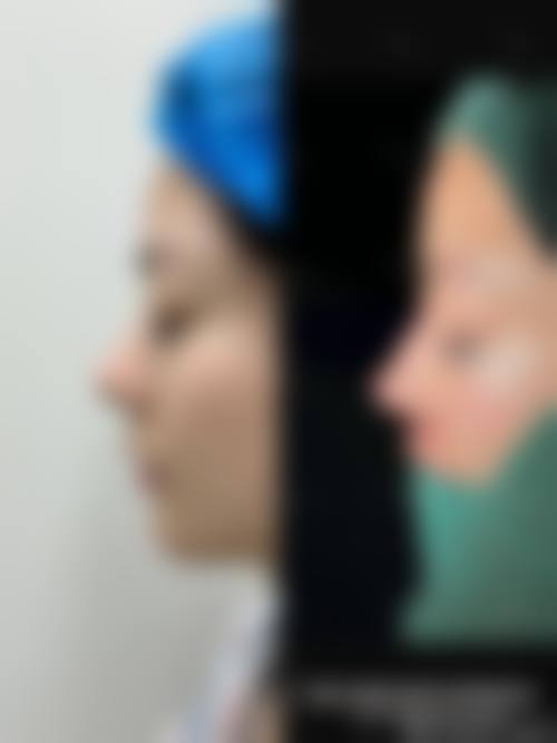 七、厦门思明宇娜缇娅整形医院价格表:(仅供参考)