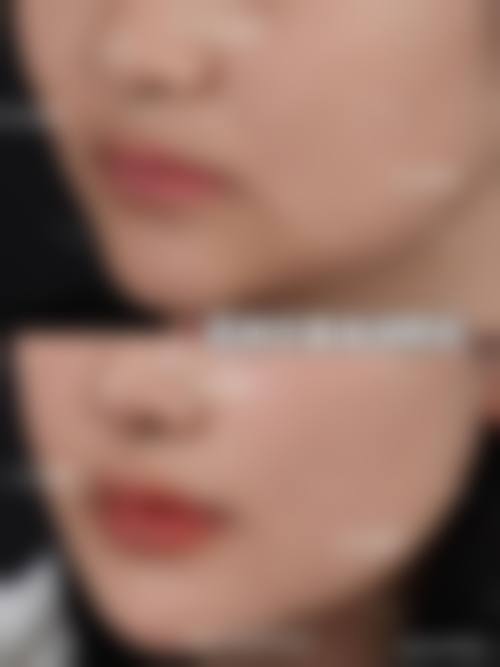 六、贵阳科珑小可整形医院怎么预约：