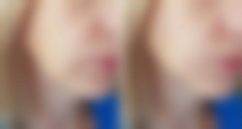 八、贵阳科珑小可整形医院真实的顾客评价如下：