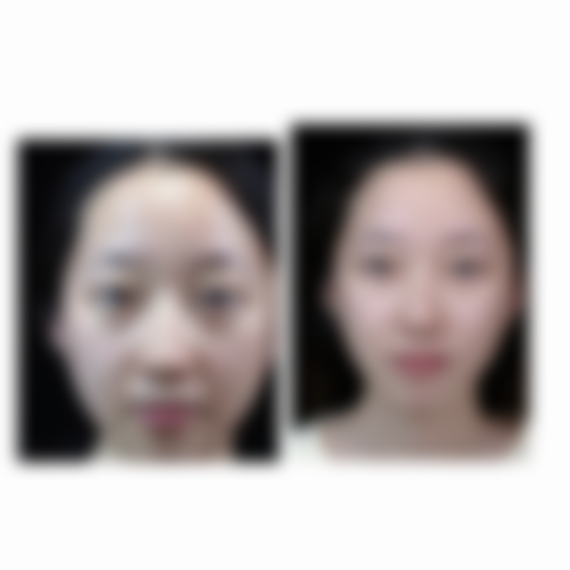 如果想找邹浅医生做手术该怎么做