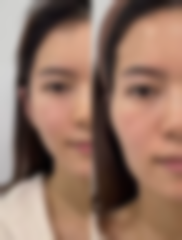 五、成都华生铂悦医疗美容整形门诊部实例