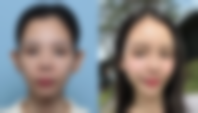 七、惠州瑞芙臣医疗美容诊所价格表:(仅供参考)