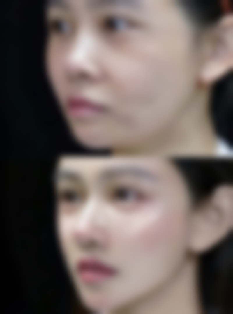 揭秘标准注射分配:科学配比,成效更佳