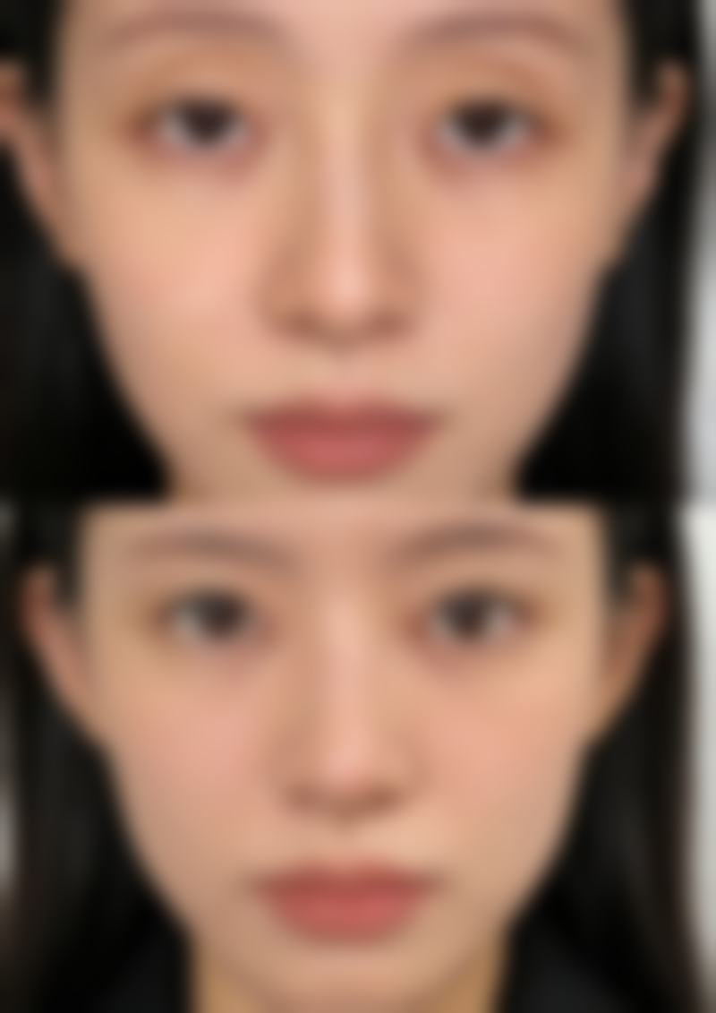 八、厦门思明宇娜缇娅整形医院真实的顾客评价如下: