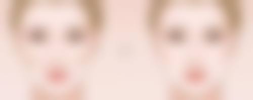 抽脂手术修复时间大揭秘!个人体质不同,修复速度不一样