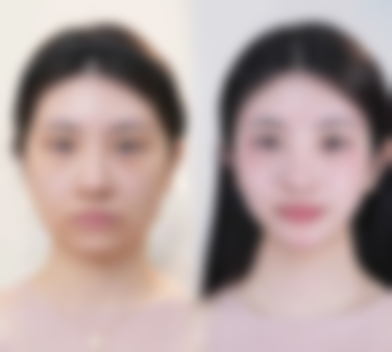 七、指宿美肌诊所价格表：（仅供参考）