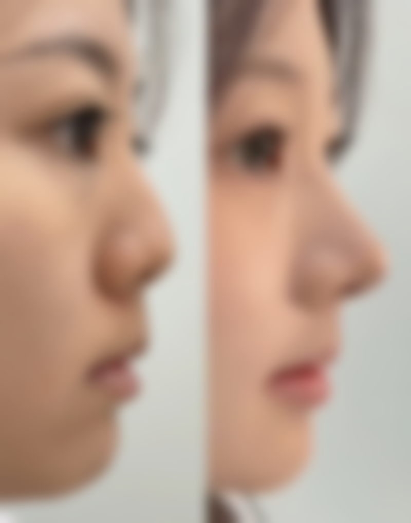 五、广州远东美容整形医院实例